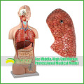 Lehrmodelle Plastic Human Torso Anatomie mit abnehmbaren Organen
